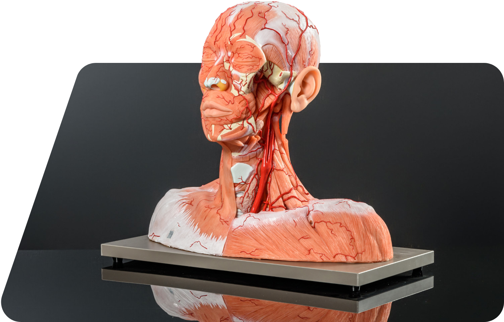 model-1